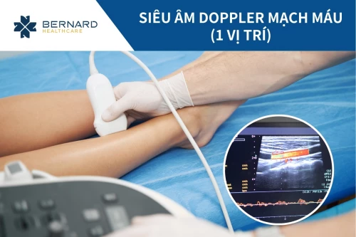 Siêu âm doppler mạch máu (1 vị trí)